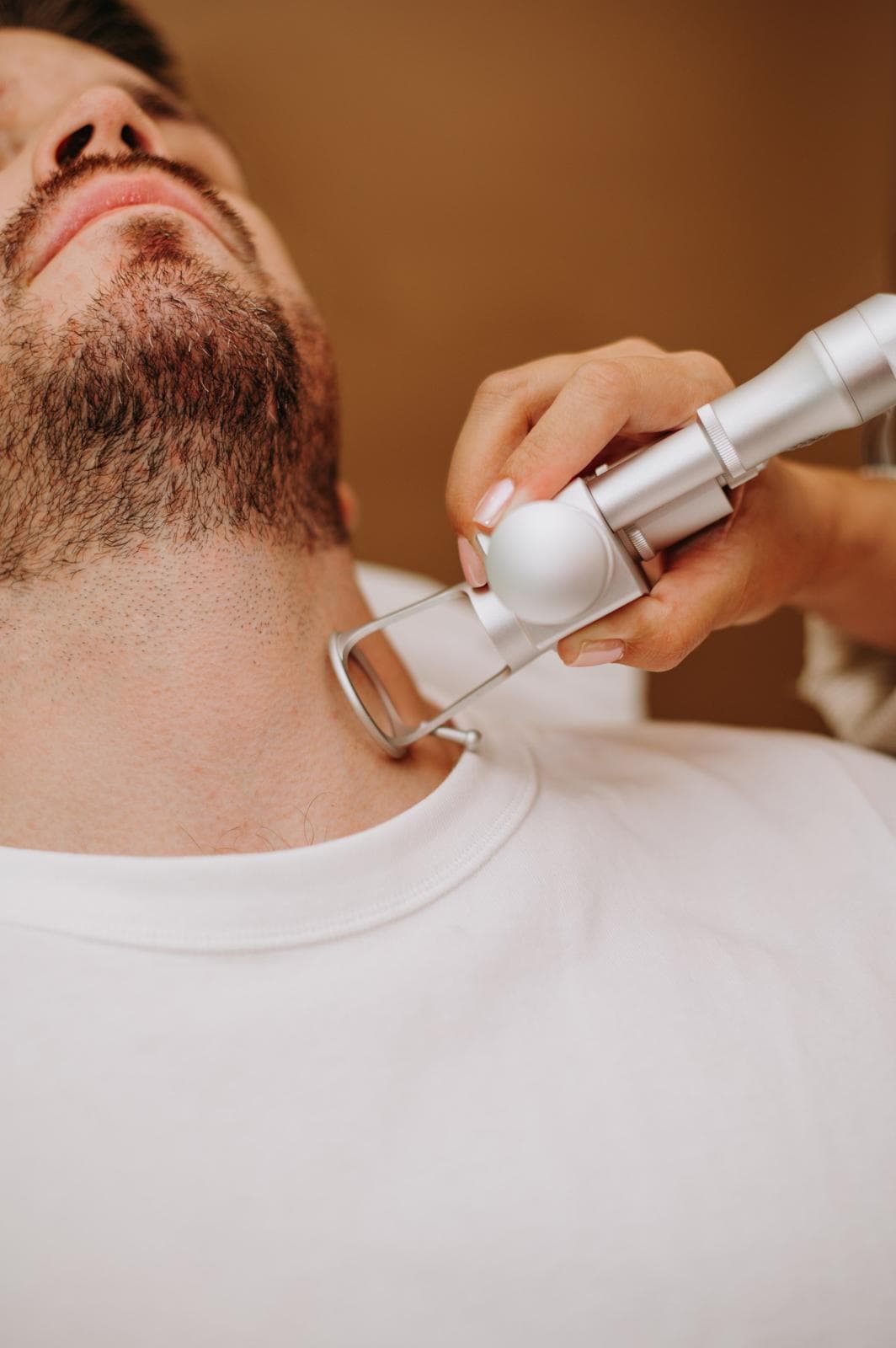 CO2 Fractional Laser Resurfacing
